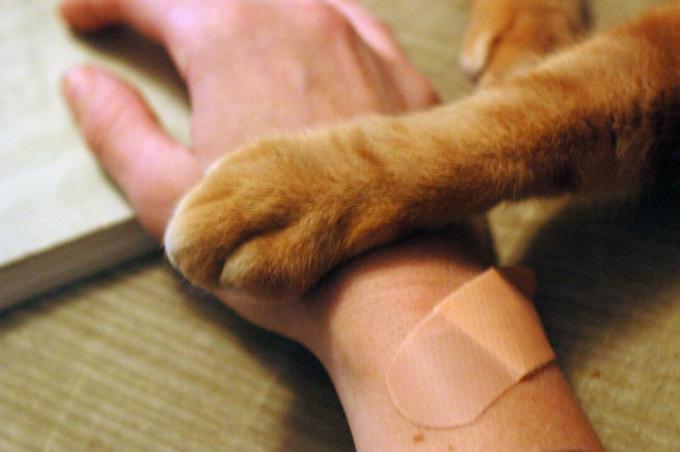 Eine bandagierte menschliche Hand und eine Katzenpfote.